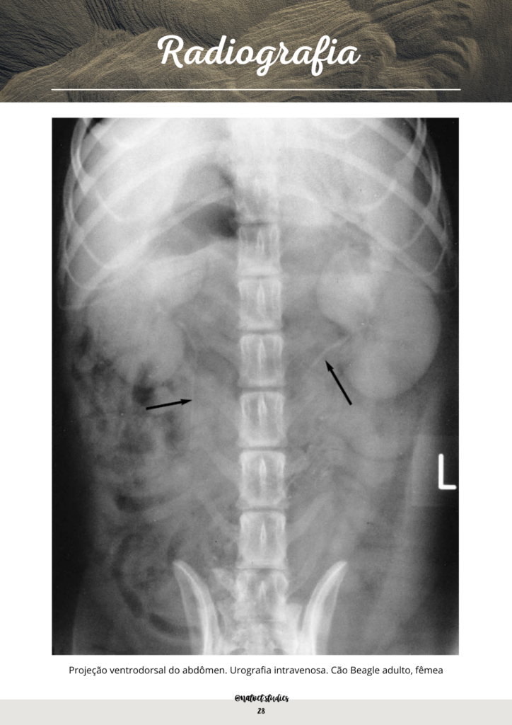 radiografia sist renal